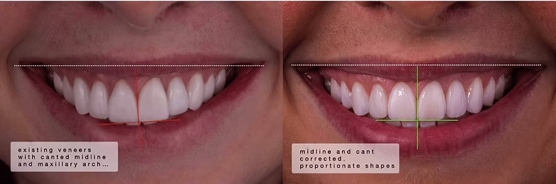 canted smile